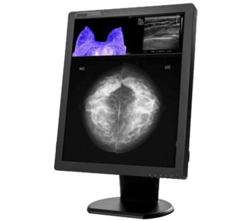 Double Black Imaging Image Systems 5MP Color Diagnostic Display (C5MPN) Double Black Imaging Image Systems 5MP Color Diagnostic Display (C5MPN)
